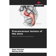 (영문도서)Precancerous lesions of the anus Paperback, Our Knowledge Publishing, English, 9786209139147
