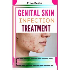 (영문도서) Genital Skin Infection Treatment: Your Essential Guide To Recognizing Symptoms ... Paperback, Independently Published, English, 9798310759695