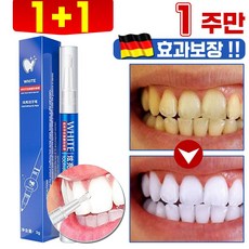 독일개발 화이트닝 셀프 치아 미백제 치아 미백 펜 겔 구강 위생 케어 입냄새 누렁니 얼룩 제거 프리미엄 3g, 2개