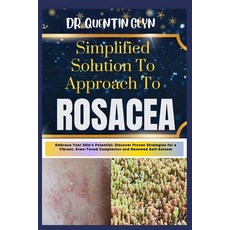 (영문도서) Simplified Solution Approach To ROSACEA: Embrace Your Skin's Potential: Discover Proven Strat... Paperback, Independently Published, English, 9798876709585