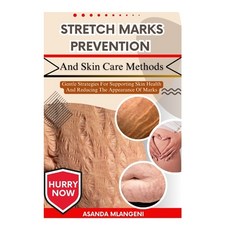 (영문도서)Stretch Marks Prevention And Skin Care Methods: Gentle Strategies For Supporting... Paperback, Independently Published, English, 9798263483937