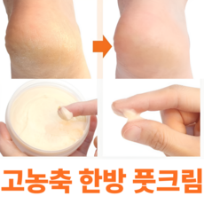 제이블릭 고농축 고보습 제형 바세린 발뒤꿈치무좀 각질연화 풋크림 발각질 제거발톱 무좀약 연고 발각질 연화제 크림 발바닥 각질제거제, 1개입, 2개