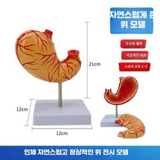 대장 병리 모델 소화기 모형 소화기관 해부학 교육용 인체, 1개, 위 모델