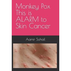 (영문도서) Monkey Pox This is ALARM to Skin Cancer Paperback, Independently Published, English, 9798841468066