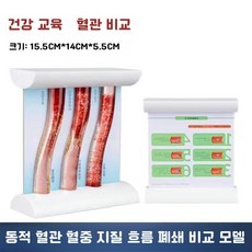 혈관모형 동맥 정맥 해부학 심혈관 교육 실습, 1개