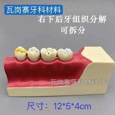 치아 충치 구강모형 우식 발달 교육 실습용 교구 이빨 잇몸 해부, 오른쪽 아래 치아 조직 분해 모델 M9