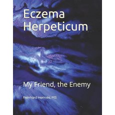 (영문도서) Eczema Herpeticum: My Friend the Enemy Paperback, Independently Published