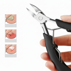 심바로 파고드는 발톱 고급형 발톱깎이, 1개, 블랙