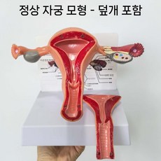 모형 자궁모형 난소 산부 교육 해부학 구조 상담 인체모형 인체 교육용 뼈, 3. 정상 자궁(뚜껑 카드포함)