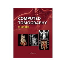 (할인 상품) 전산화단층촬영, 아카데미아, 조평곤 외