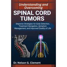 (영문도서)Understanding and Overcoming Spinal Cord Tumors: Stepwise Strategies for Early D... Paperback, Independently Published, English, 9798267021289
