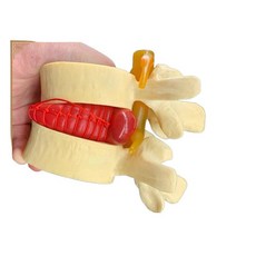 요추 척추 증폭 디스크 압축 골격 뼈 데모 모델 모형, 흰색 스타일