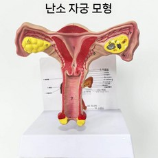 모형 자궁모형 난소 산부 교육 해부학 구조 상담 인체모형 인체 교육용 뼈, 1. 난소 자궁(카드포함)