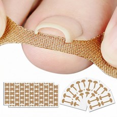 집에서도 혼자서도 내성 발톱 테이프 밴드 2종 셀프 케어 1+1, 80개