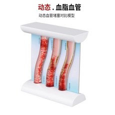 동맥경화 인체모형 심혈관 단면 교육용 해부학 혈관모형 학교, 동적 지질 비교 모델