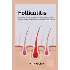 (英文圖書)Folliculitis: Symptoms Causes and Treatments of the Hidden Skin Struggle Behin... 平裝版, Independently Published, 英文