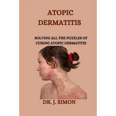 (영문도서) Atopic Dermatitis: Solving All the Puzzles of Curing Atopic Dermatitis Paperback, Independently Published, English, 9798876236876