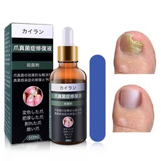 [국내배송] 거품나는앰플 발톱 곰팡이 한번에 끝내는 손발톱 영양제 발톱 앰플 문제성발톱 발톱 앰플 문제성발톱, 1개, 30ml, 1개입