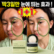 【의학 연구급 100% 기미 개선】기미 케어 미백 크림 나이아신아마이드 기미크림, 50g, 2개