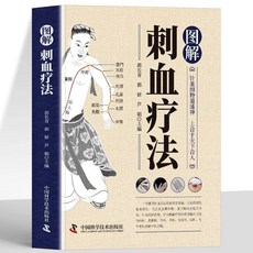 圖解刺血療法 刺血療法全真圖解 中國民間刺血術刺血療法大全針刀【椰子圖書 】