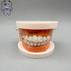 치과 치아 실습 모형 치열 브라켓 교정 기구, 소형브러시전면세라믹브래킷와이어있음투명매듭링포함, 1개, 1L