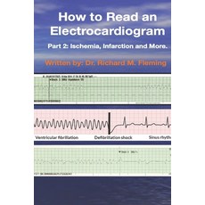 How to Read an Electrocardiogram: Part 2: Ischemia Infarction and More. Paperback, Independently Published, English, 9798567254400