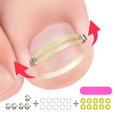 인생필품_설치쉬운 내성발톱 보호대_양발사용 수량+여분 팁1개, 1세트