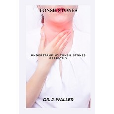 (영문도서) Tonsil Stones: Understanding Tonsil Stones Perfectly Paperback, Independently Published, English, 9798879259179