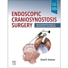 Endoscopic Craniosynostosis Surgery: An Illustrated Guide to Endoscopic Techniques, Elsevier