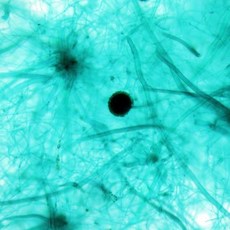 실험용 누룩곰팡이 슬라이드 표본 융합사고 발명키트 교사연수 창의과학