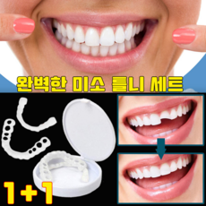 실리콘 상하 세트 이빨 셀프 만들기 미아 장식 세트, 1세트