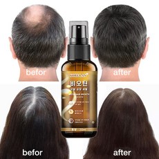 탈모 치료/머릿결개선/모발 강인화, 1개, 20ml