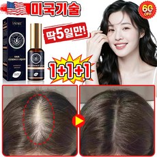 [빠른효과] 미국기술 1/1+1/2+2 두피 영양제 머리 발모제 모발 성장 촉진 에센스 탈모 방지 완화 두피케어 세럼 포장증정, 3개, 30ml