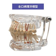 치열 교정 치아모형 치과 구강 모델 덴티폼 금속 교정기 구조, 전악 병리학 32개 치아