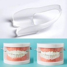 수면용 마우스피스 수면 스플린트 치아 이빨 이악물기lov4+7oeQ, 1개