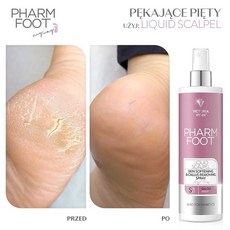 빅토리아빈 우레아 풋케어 풋스파 (발톱무좀 무좀) 문제성 손발톱치료 안티펑거스, 1개, 1개입