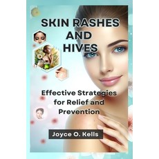 (영문도서) Skin Rashes and Hives: Effective Strategies for Relief and Prevention Paperback, Independently Published, English, 9798333644848