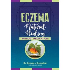 (영문도서) Eczema: Natural Healing Without Medication Paperback, G.M.G. Da Vinci Health Ltd, English, 9789925569229