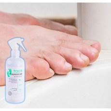 발가락사이습진 발냄새제거법 지간형무좀 수포형무좀 발바닥무좀, 300g, 1개, 1개입