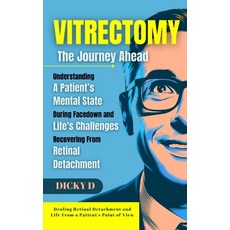 (영문도서) Vitrectomy: The journey ahead Paperback, Independently Published, English, 9798305031058