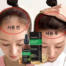 Hair Hair Grower 영 양 두 피 케 어 세 럼, 2개, 30ml