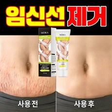산후 임신주름 제거 비만주름 청소년 성장주름 케어 크림, 3개, 50g