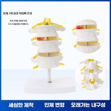 척추 모형 모델 해부학 인체 교육용 디스크 모델 신경 골반, 1개, 3단 요추 모델