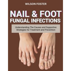 (영문도서)Nail & Foot Fungal Infections: Understanding The Causes And Supportive Strategie... Paperback, Independently Published, English, 9798269465302