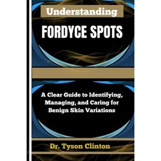 (英文圖書)Understanding Fordyce Spots: A Clear Guide to Identifying Managing and Caring... 平裝版, Independently Published, 英文