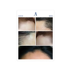 에이 실사 고무판 3종 반영구재료 입술 헤어라인 입술 아이라인 연습용, 1개