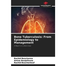 (英文圖書)Bone Tuberculosis: From Epidemiology to Management 平裝版, Our Knowledge Publishing, 英文