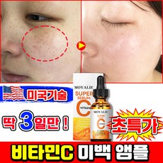 [피부과 추천] 미국개발 1/1+1/2+2 비타민C 앰플 기미앰플 비타민c 세럼 비타민 미백 앰플 기미 잡티 색소침착 미백 화이트닝 LUPEIYA, 1개, 30ml