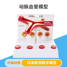 동맥경화 모형 혈관 교육용 교구 폐쇄 비교 심혈관 내과 모델, 갈라진 혈관 모형