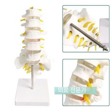 인체모형 요추 척추 정형 흉추 외과 퇴행성 모델 골격 해부학 배측방 후외측, A.작은골반